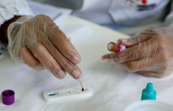 Mais de 190 casos de DSTs foram identificados durante a folia em Salvador