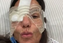 Ivete Sangalo dá detalhes de recuperação após cirurgia no rosto: ‘Tá babado’