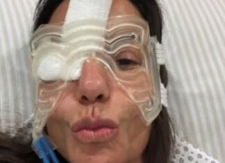 Ivete Sangalo dá detalhes de recuperação após cirurgia no rosto: ‘Tá babado’